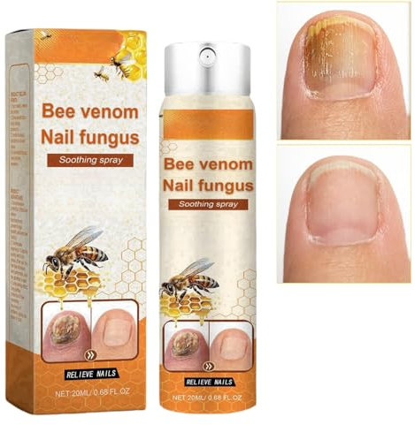 Bee Venom Nail Soothing Spray for Toenail,Bee Venom Nail Fungus Soothing Spray,Nail Fungus Treatment,Nail Strengthener for Damaged Nails,Bee Venom Nail Treatment Serum,Nail Repair Treatment
