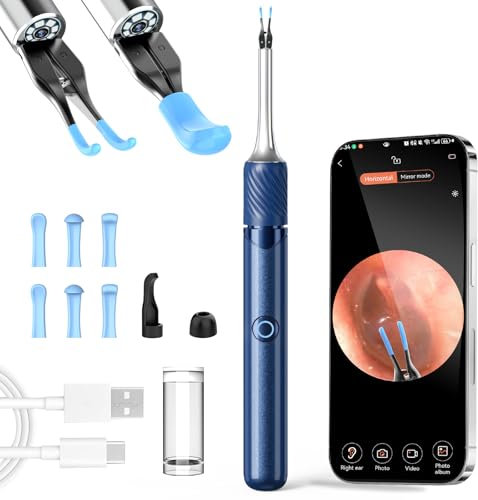 VITCOCO Ear Wax Removal Tool with Visual Tweezers, Ear Cleaner Kit with 2 Mode Ear Pick and Tweezers, Ear Camera Kit with Light, Earwax Remover Kit Otoscope for iOS,Android, Adults, Kids, Pets