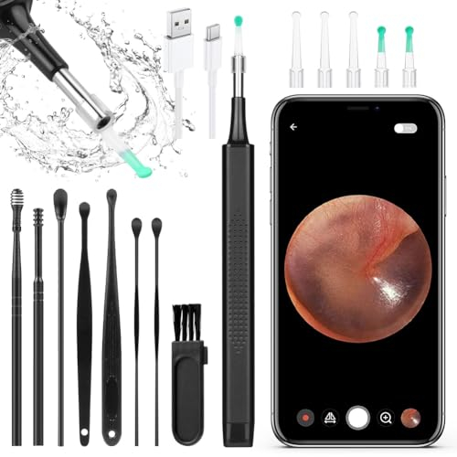 ACWOO Otoscopio Endoscopio, Otoscopio Digital, Endoscopio de Oído, Oidos Camara 5040P WIFI Limpiador Oidos con 6 LED, 3,5mm HD Endoscopio Oido, Kit de Limpiador de Oídos para iOS y Android (Negro)