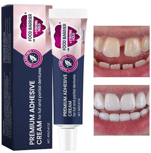 Crema adesiva – Crema protesi sicura | 40 g di crema per protesi per una presa sicura | Colla dentale per denti | protesi in silicone | Rinnova e stringe protesi superiori e inferiori allentate e