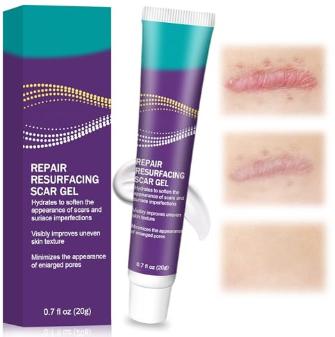 15g Crema Cuidado Cutánea, Cuidado Diario De La Piel, Operación simple, Adecuado Para la cara y el cuerpo