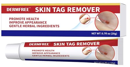 Skin Tag Remover Cream, Wart Removal, Effective Treatment of Warts, Corns Spot Moles, Moles and Calluses, Wart Remover Cream for Face, Body and Hands