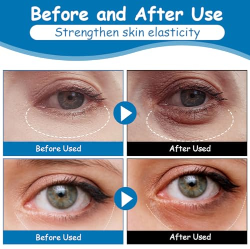 EIHI 60 Pièces Patch Yeux Collagene et Acide Hyaluronique, Patchs pour Les Yeux Collagène Yeux Éclaircir Les Cernes, Réutilisable contre les cernes Poches Rides Cercles foncés Puffiness