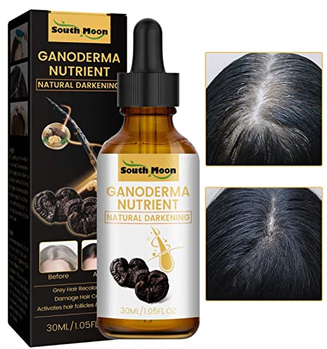 SHRIGM Anti canas,Loción hidratante nutritiva para el Cabello con Esencia anticanas para Hombres - Aceite Natural para el Crecimiento del Cabello 30 ml, para Detener el Adelgazamiento